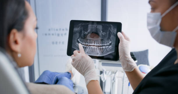 Licensed Tooth Extraction service in Stony Brook, NY - Smile Center Dentistry